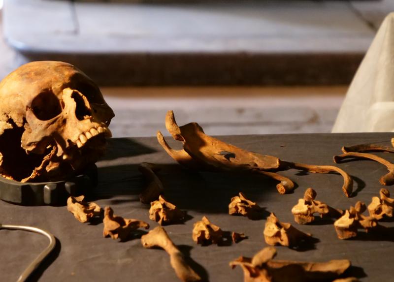 Uno dei crani rinvenuti nel Sepolcreto della Ca' Granda