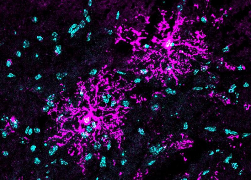 Cellule GPR17ALS-1 positive