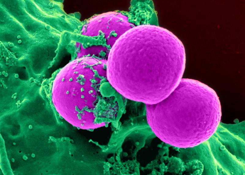 Cellule adipose circondate da tessuto