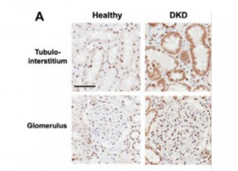 NBL1 expression in kidney