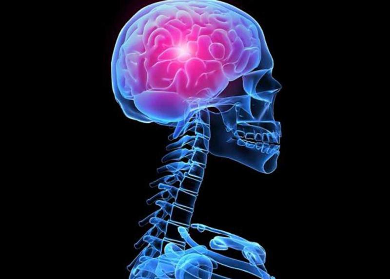 Un glioblastoma