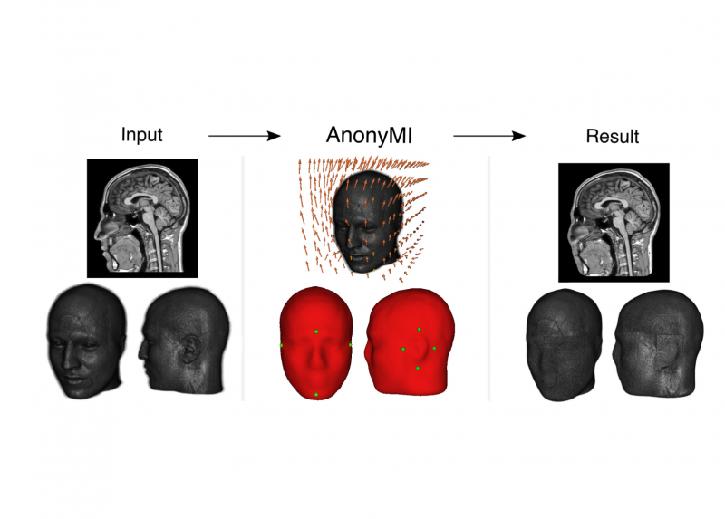 Il funzionamento di AnonyMI per de-identificare immagini di risonanza magnetica