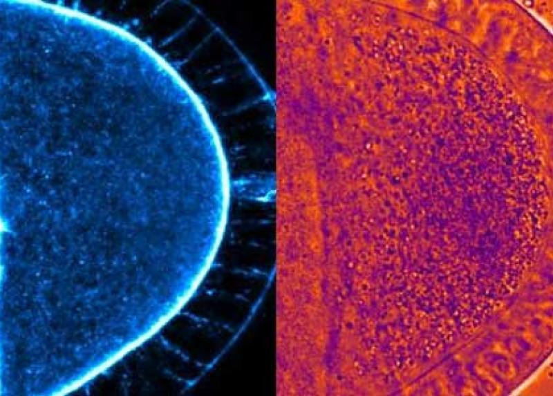 Immagini microscopiche di un oocita di Drosophila