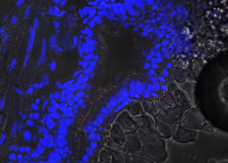 Microplastiche