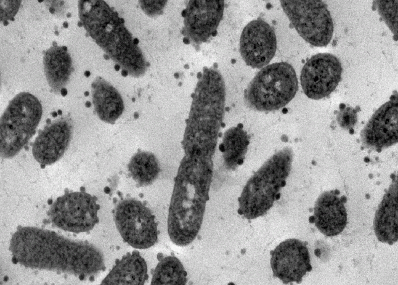 Immagine al microscopio elettronico di Pseudomonas aeruginosa