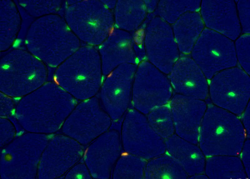 La proteina Nfix Pax7 al microscopio