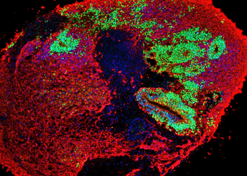 L'immagine di un organoide cerebrale