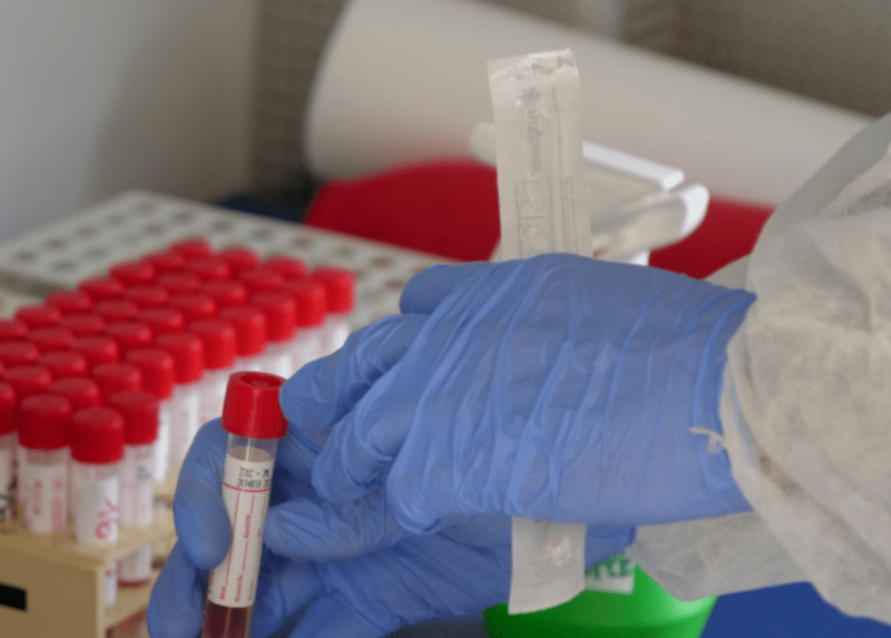 Raccolta di tamponi per l'analisi Covid
