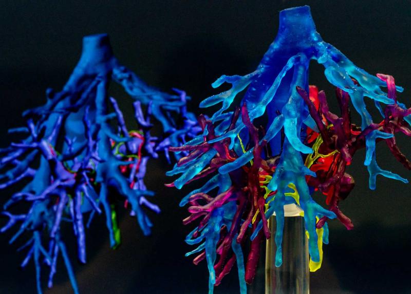 Ricostruzione in 3D di un neurone