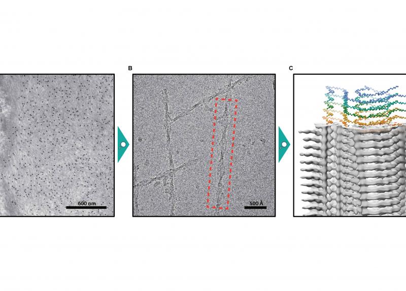 Analisi ad alta risoluzione della struttura tridimensionale di fibrille amiloidi