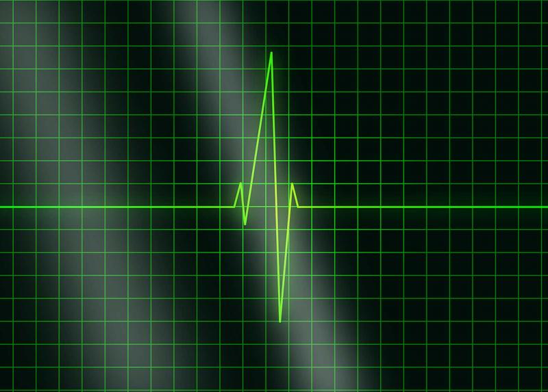Traccia di impulso cardiaco