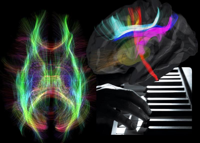 Immagine composta da Luca Viganò, primo autore dello studio pubblicato su Brain