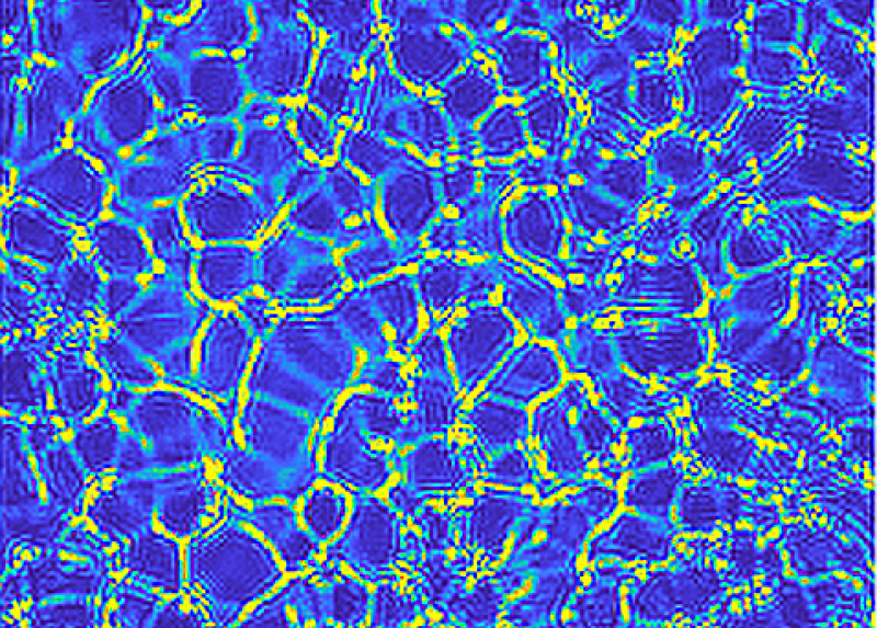 Nell'immagine: il tipico pattern che si forma durante la nuova instabilita' idrodinamica, causata dalla diffusioforesi di nanoparticelle colloidali in miscele liquide, scoperta dal team della Statale. Le zone piu' luminose corrispondono ad elevate concentrazioni locali di nanoparticelle colloidali, mentre le zone piu' scure corrispondo a concentrazioni molto basse di colloide