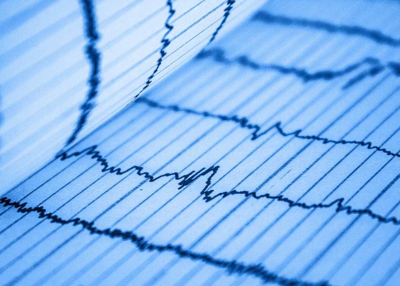 Il tracciato di un elettrocardiogramma