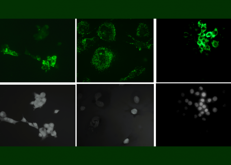 Nel pannello compaiono, partendo da sinistra: osteociti, osteoblasti e osteoclasti (fila superiore localizzazione delle nanoplastiche, fila inferiore visibili i nuclei e i contorni delle cellule
