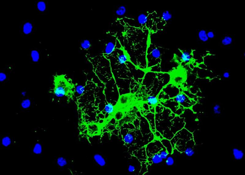 Oligodendrociti, responsabili della produzione di mielina