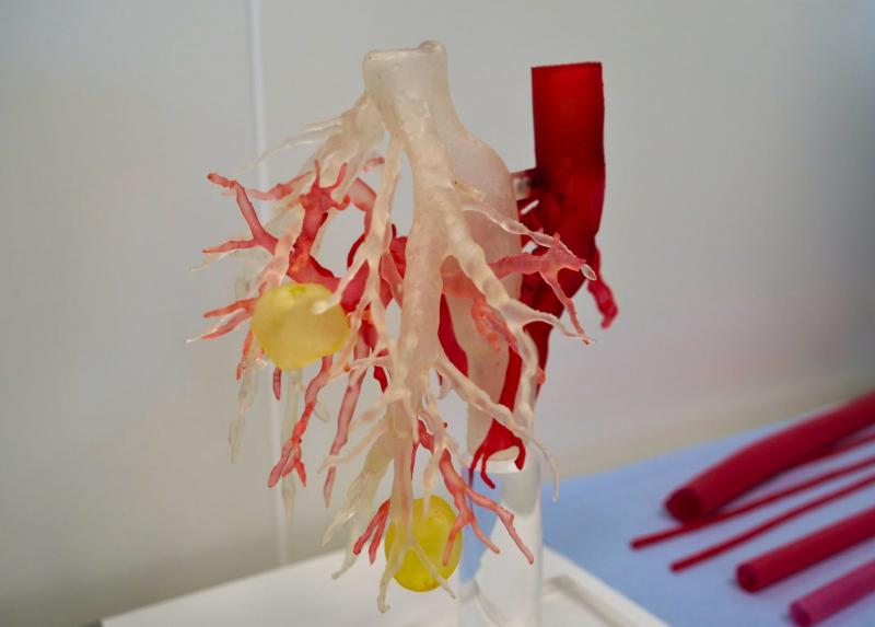 Una delle riproduzioni di organi di PRINTMED-3D.