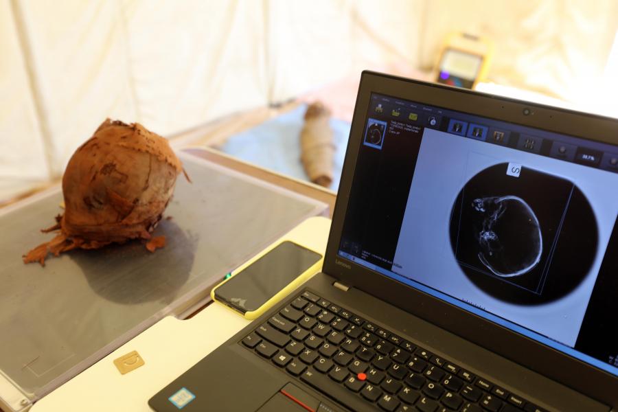 Analisi radiologica della testa di un bambino mummificata, eseguita sul sito della necropoli con una macchina a raggi X portatile  - Credit: Egyptian-Italian Mission at West Aswan (EIMAWA)