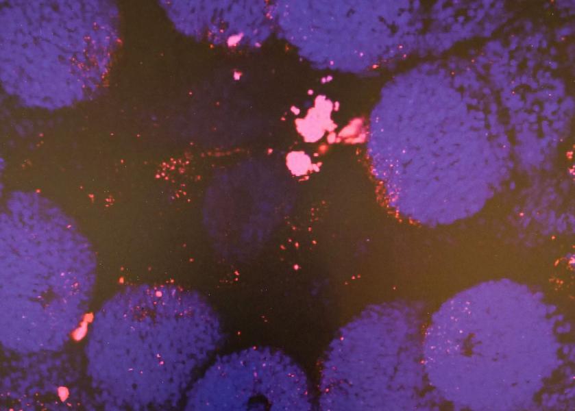 Dettagli immagine al microscopio con nanoplastiche.