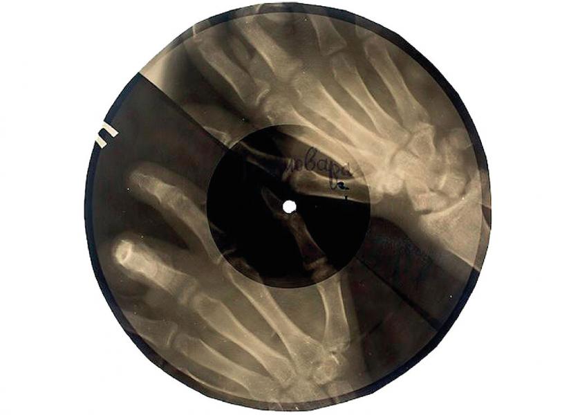 Dischi su lastre per radiografie ossee