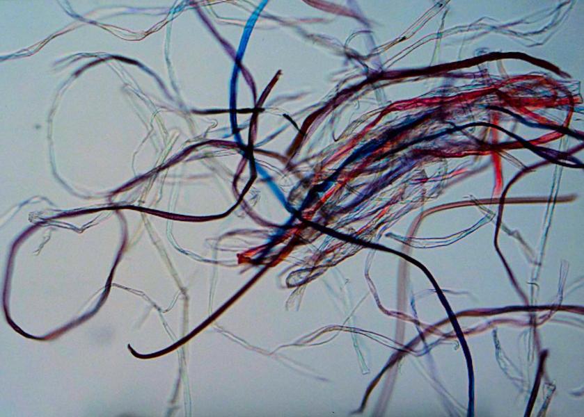 Immagine al microscopio di fibre di poliestere.