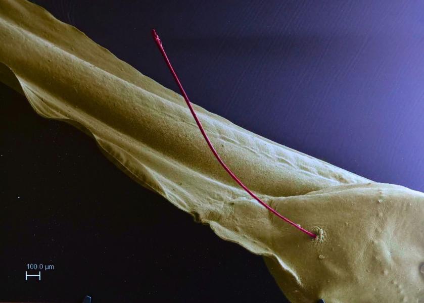 Immagine al microscopio di un girino di anfibio Xenopus laevis.