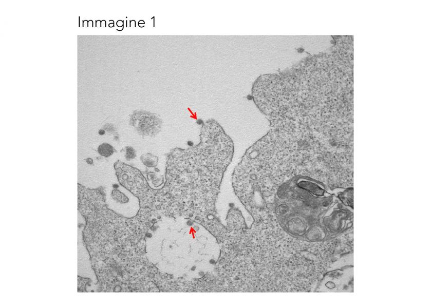 Le particelle virali di SARS-CoV-2 (indicate dalle frecce), adese alle membrane sulla superficie e all’interno di cellule VERO E6 utilizzate per l’isolamento