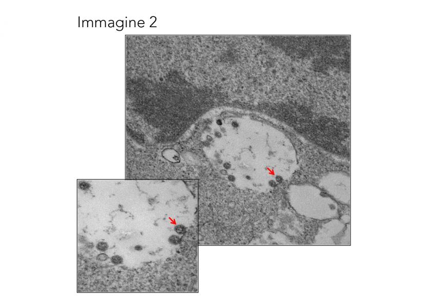 Combinazione di due immagini a diverso ingrandimento (50000X e 140000X) che mostra le particelle virali con la tipica ultrastruttura caratterizzata dalla corona di glicoproteine superficiali
