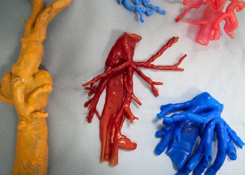 Stampa 3D nel laboratorio PRINTMED-3D.